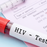 ශ්රී ලංකාවේ HIV ආසාදිතයින් සංඛ්යාව ඉහළට – UNAids නවතම වාර්තාවක් හෙළි කරයි